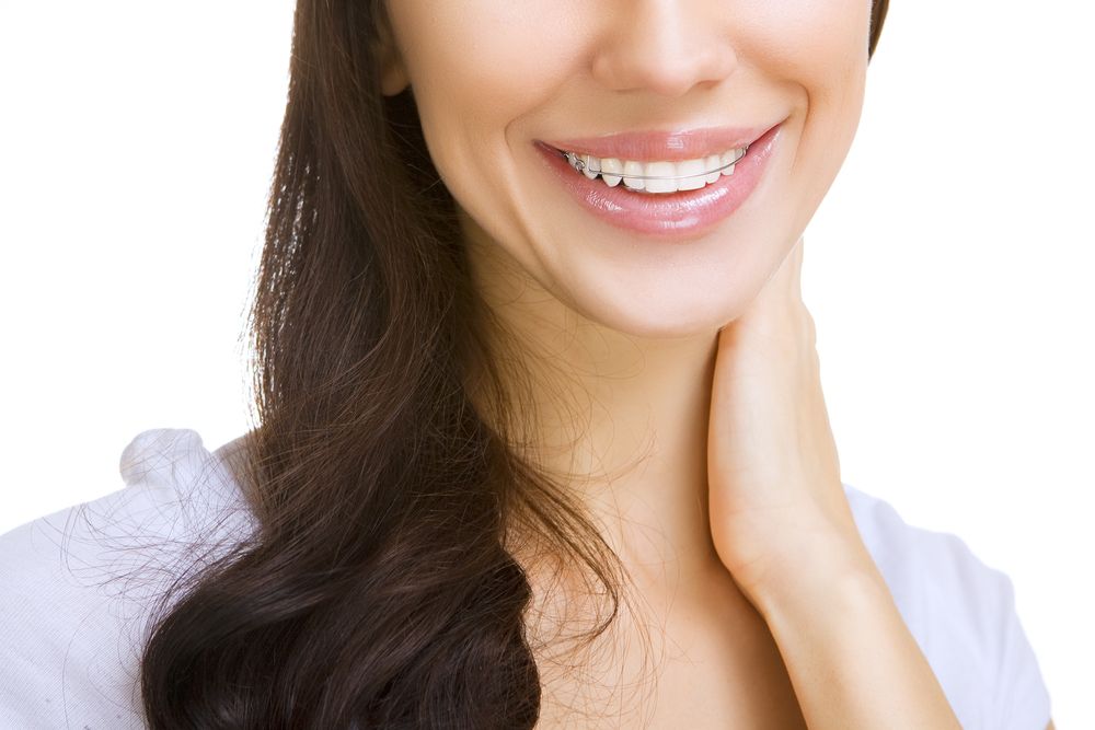 2nd woman with clear dental retainer